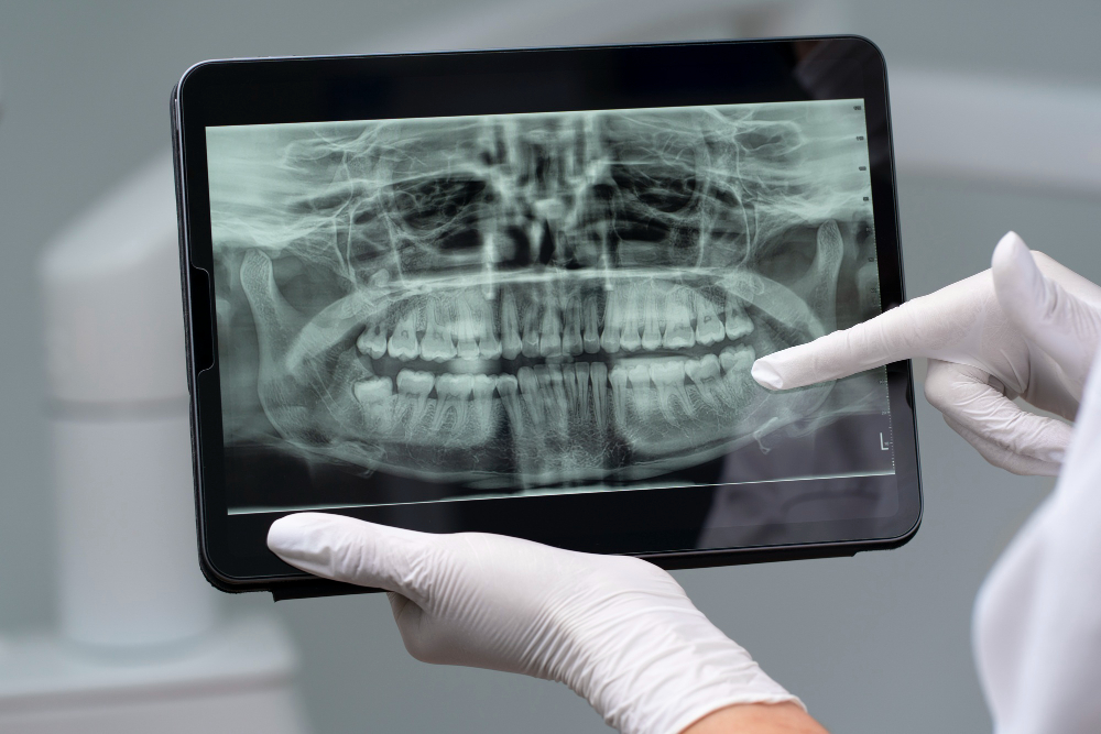 Digital X-Rays  San Diego, CA
