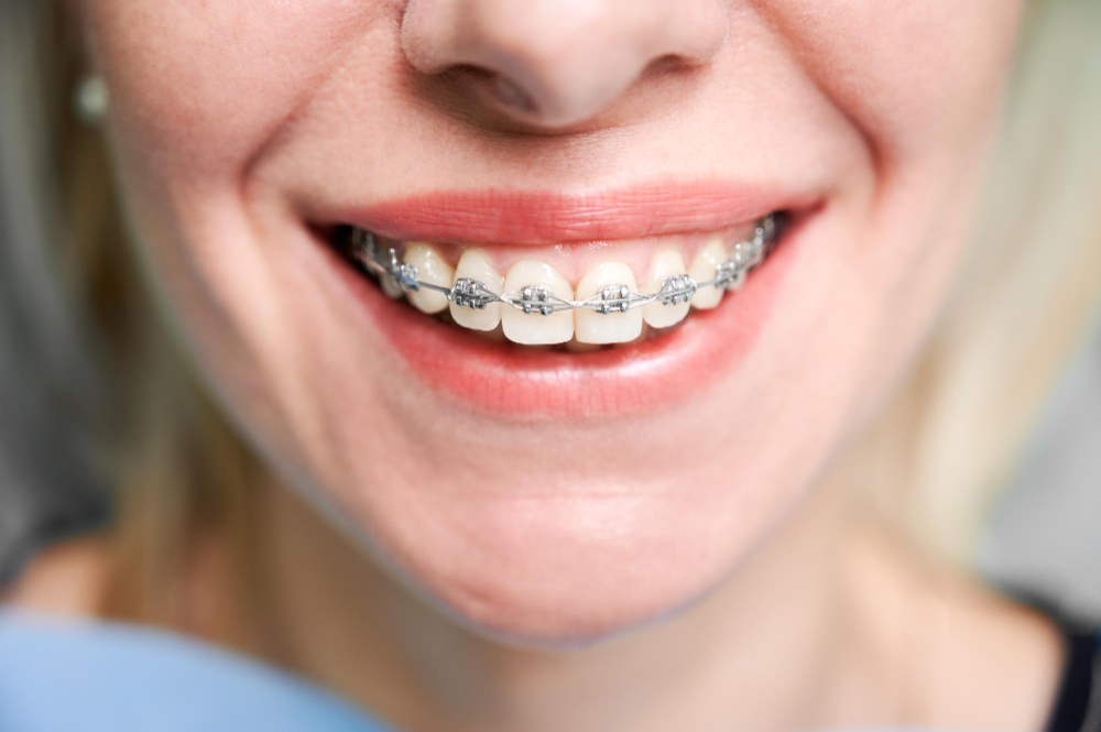 orthodontic services  San Diego, CA